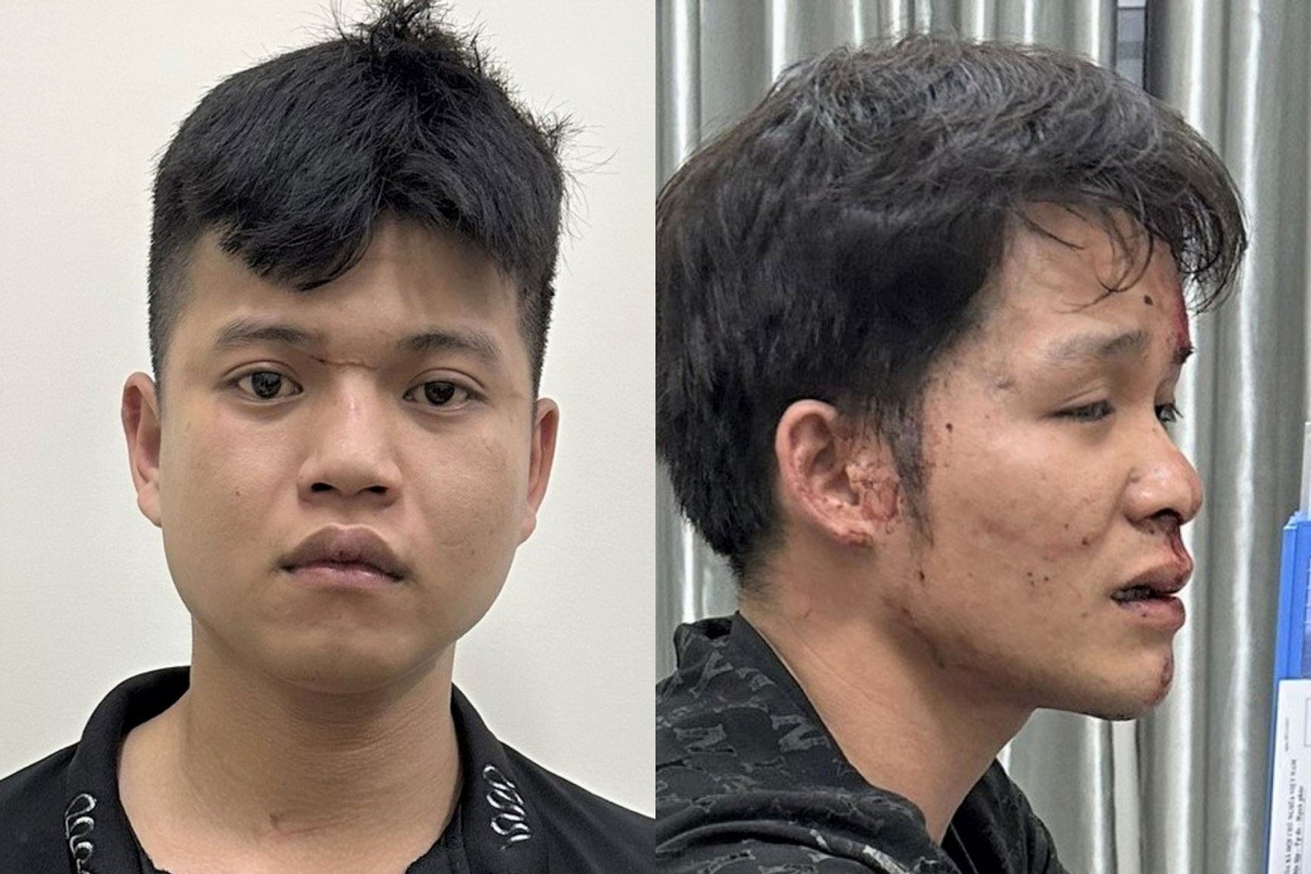 Nem da vao canh sat 911, hai thanh nien Da Nang bi bat hinh anh
