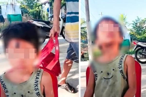Dieu tra vu be gai 6 tuoi nghi bi cha duong bao hanh o Kien Giang hinh anh