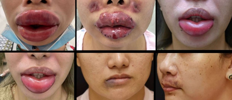 Tham my DG Luxury,  Co so DG Luxury,  Giam doc DG Luxury,  Tham my ID Korea,  Tham my E-Star anh 2