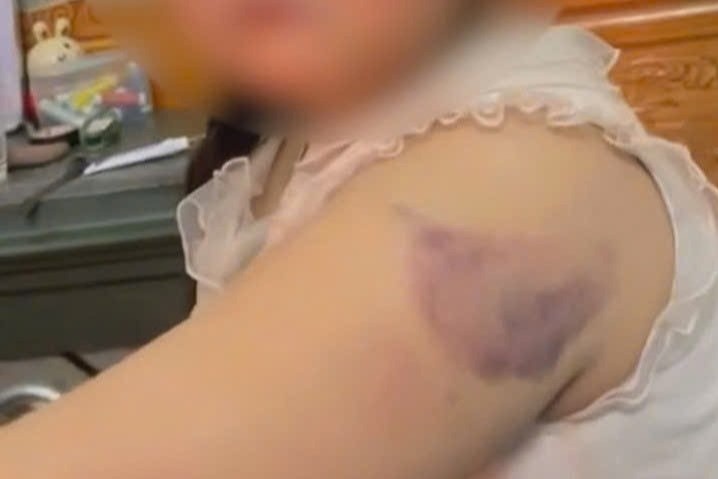 Hoc sinh lop 1 nghi bi co giao danh bam tim tay vi viet chu xau hinh anh