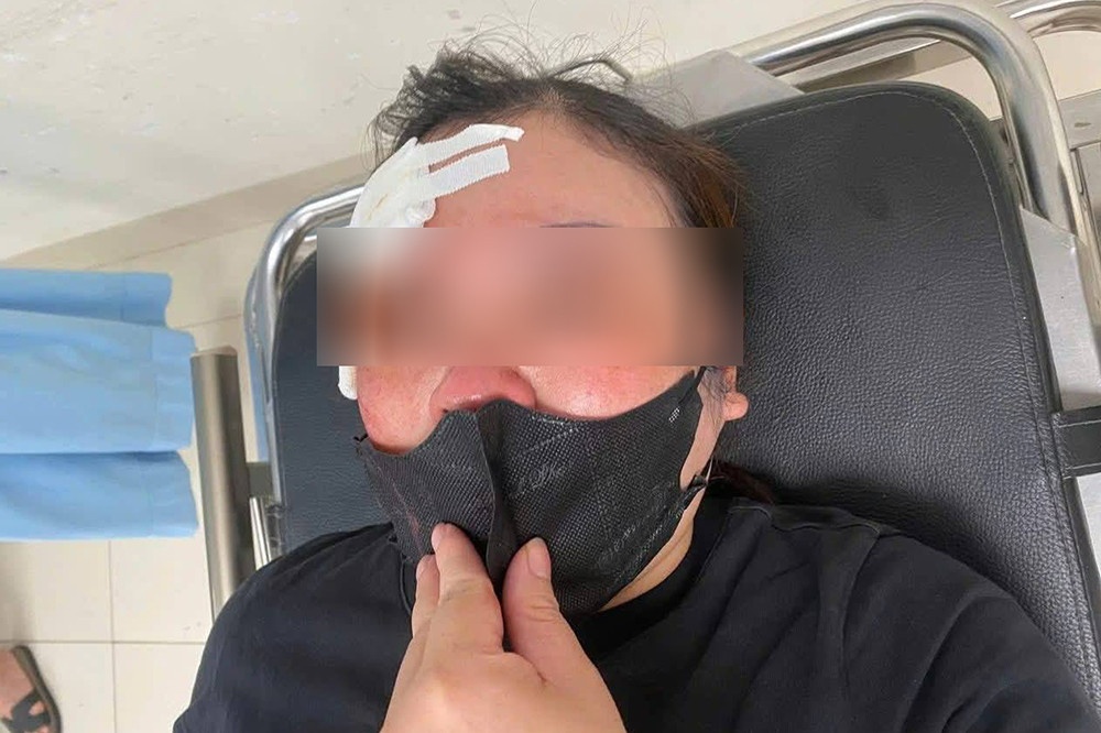 Dung dui cui,  Vut vao dau anh 1