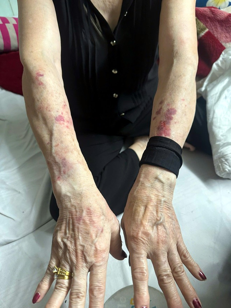 Cuop 16 cay vang,  Ba chu nha nghi,  Ha Noi anh 3