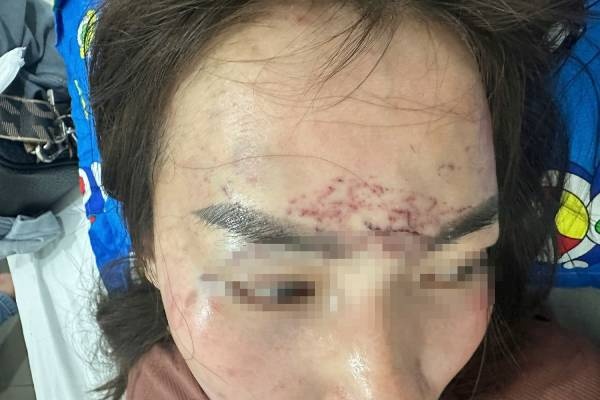 Khoi to vu nguoi phu nu di duong bi keo len oto, 'tra tan' bang axit hinh anh