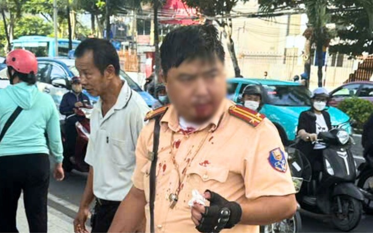 Ngo Tung Giang,  Cong an Nha Trang,  K.A,  CSGT duong bo,  Nam Nha Trang anh 1