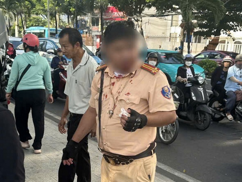 Khafizov Artur,  Ngô Tùng Giang,  Võ Thị Đoan Trang,  Công an Nha Trang,  Nam Nha Trang ảnh 1 Khafizov Artur,  Ngo Tung Giang,  Vo Thi Doan Trang,  Cong an Nha Trang,  Nam Nha Trang anh 1