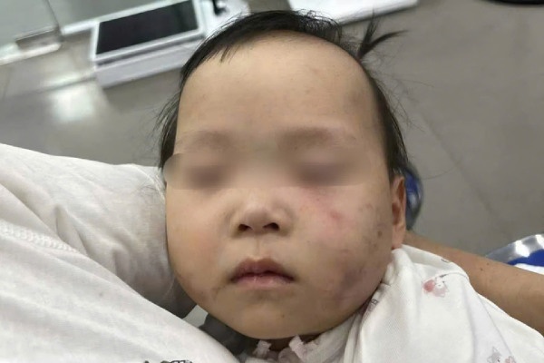 Cong an tam giu co giao trong vu be gai bi bam tim mat khi gui nha tre hinh anh