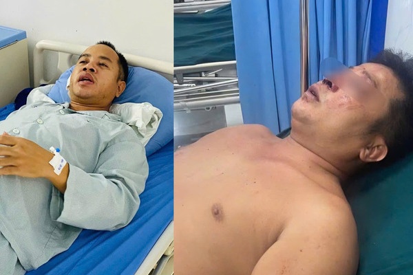 Danh tinh doi tuong hanh hung 2 anh em giup nguoi gap nan o Bac Ninh hinh anh