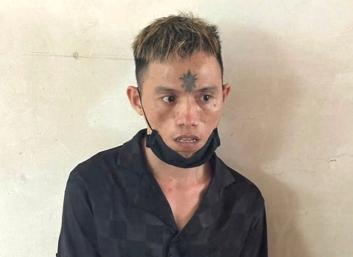 Co gai bi ke dao vao co, cuop dien thoai o cong vien hinh anh