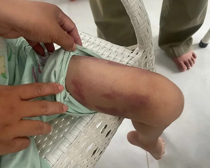 Be gai 9 tuoi bi me cung nguoi tinh danh da man trong phong tro hinh anh