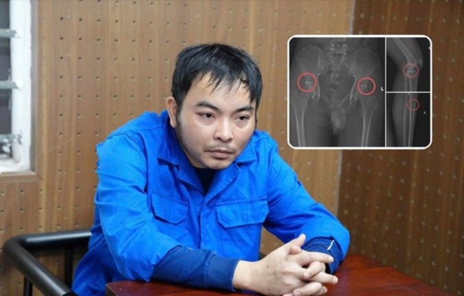 Cuu nhan vien y te duc vo xuong truc loi bao hiem: Thu doan tan nhan hinh anh