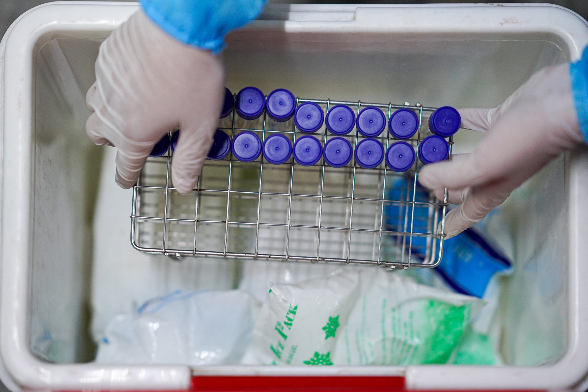 Lay mau xet nghiem Covid-19 tai TTTM anh 9