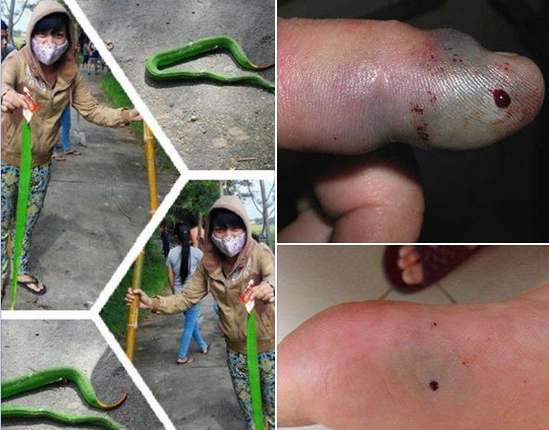 Theo chủ nhân của các trang facebook này, họ đưa hình ảnh và thông tin rắn lục đuôi đỏ nhằm mục đích cảnh báo mọi người biết và có cách phòng tránh. 