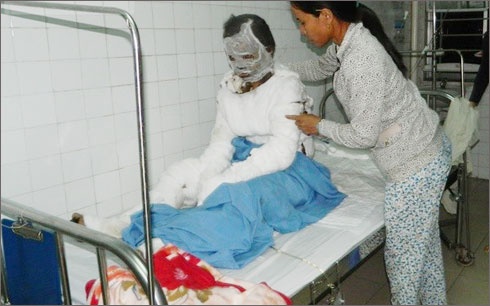 Nguoi vo tu thieu vi chong bao hanh da tu vong hinh anh