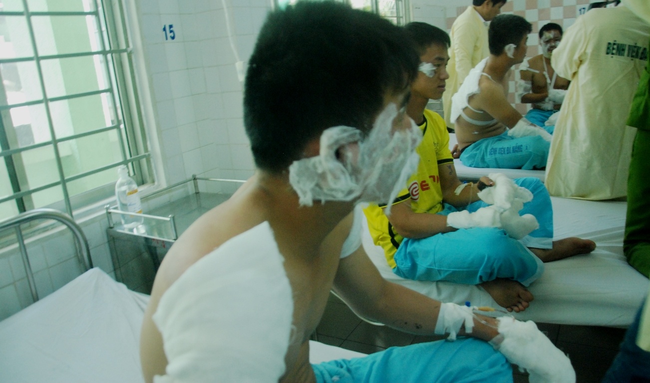 Khi đang phun nước dập lửa, một số thùng phuy chứa hóa chất dể cháy phát nổ khiến 17 cán bộ, chiến sĩ bị bỏng. Ngay lập tức, những người bị thương được đưa đến Bệnh viện Đà Nẵng cấp cứu.