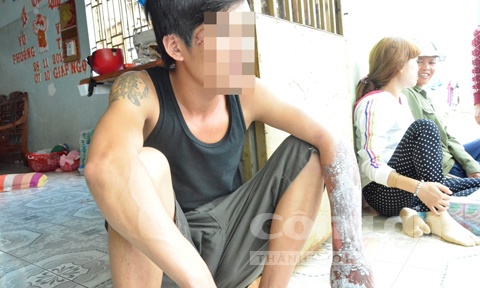 Dung xang thieu song hang xom vi bi cam hat trong dam cuoi hinh anh