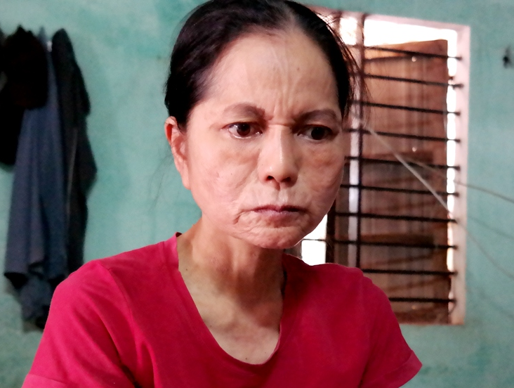 Cuoc song be tac cua 'co gai hoa ba lao' o Hoi An hinh anh