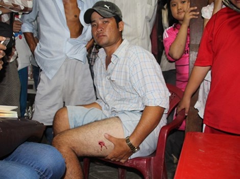 Anh Thảo bị thương ở chân trái