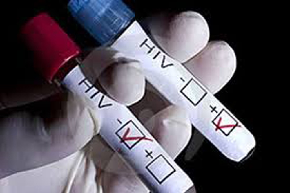 70% so nguoi nhiem HIV trong do tuoi con rat tre hinh anh