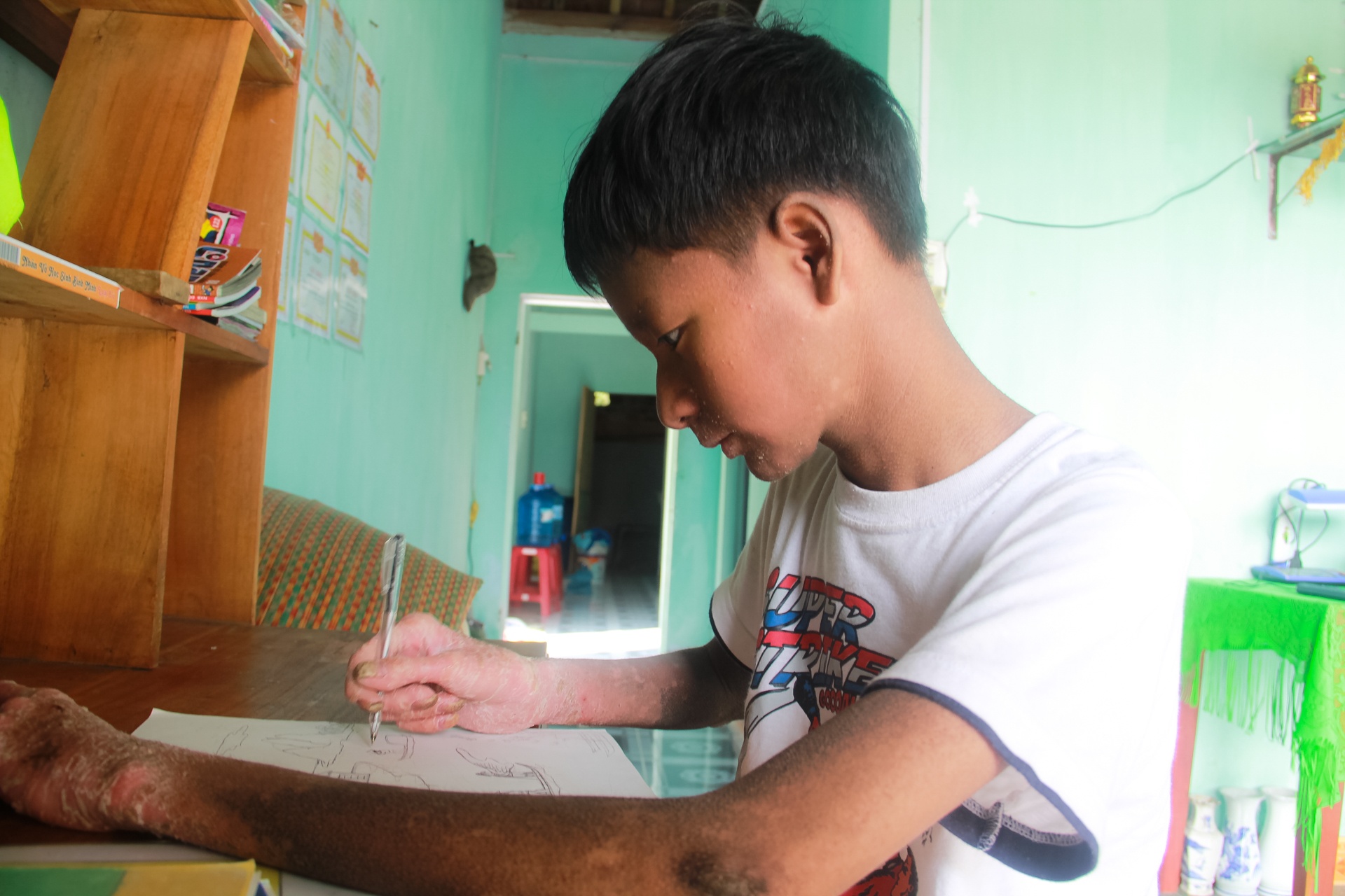 Học sinh bị bệnh lạ ở Quảng Nam ảnh 2 Hoc sinh bi benh la o Quang Nam anh 2
