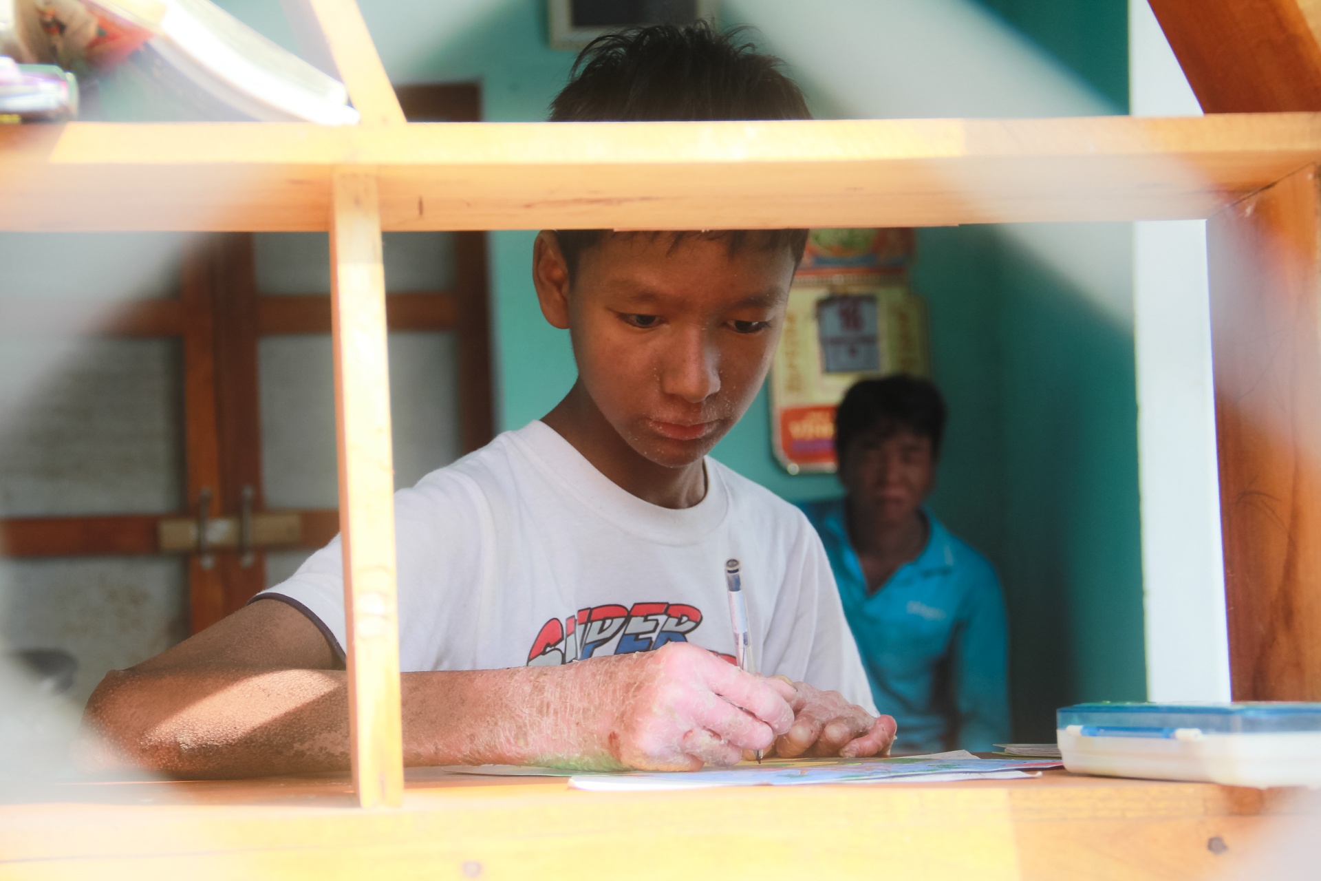 Học sinh bị bệnh lạ ở Quảng Nam ảnh 4 Hoc sinh bi benh la o Quang Nam anh 4