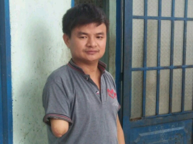 Vu 'doi den canh tay': Toa de nghi cong an vao cuoc hinh anh