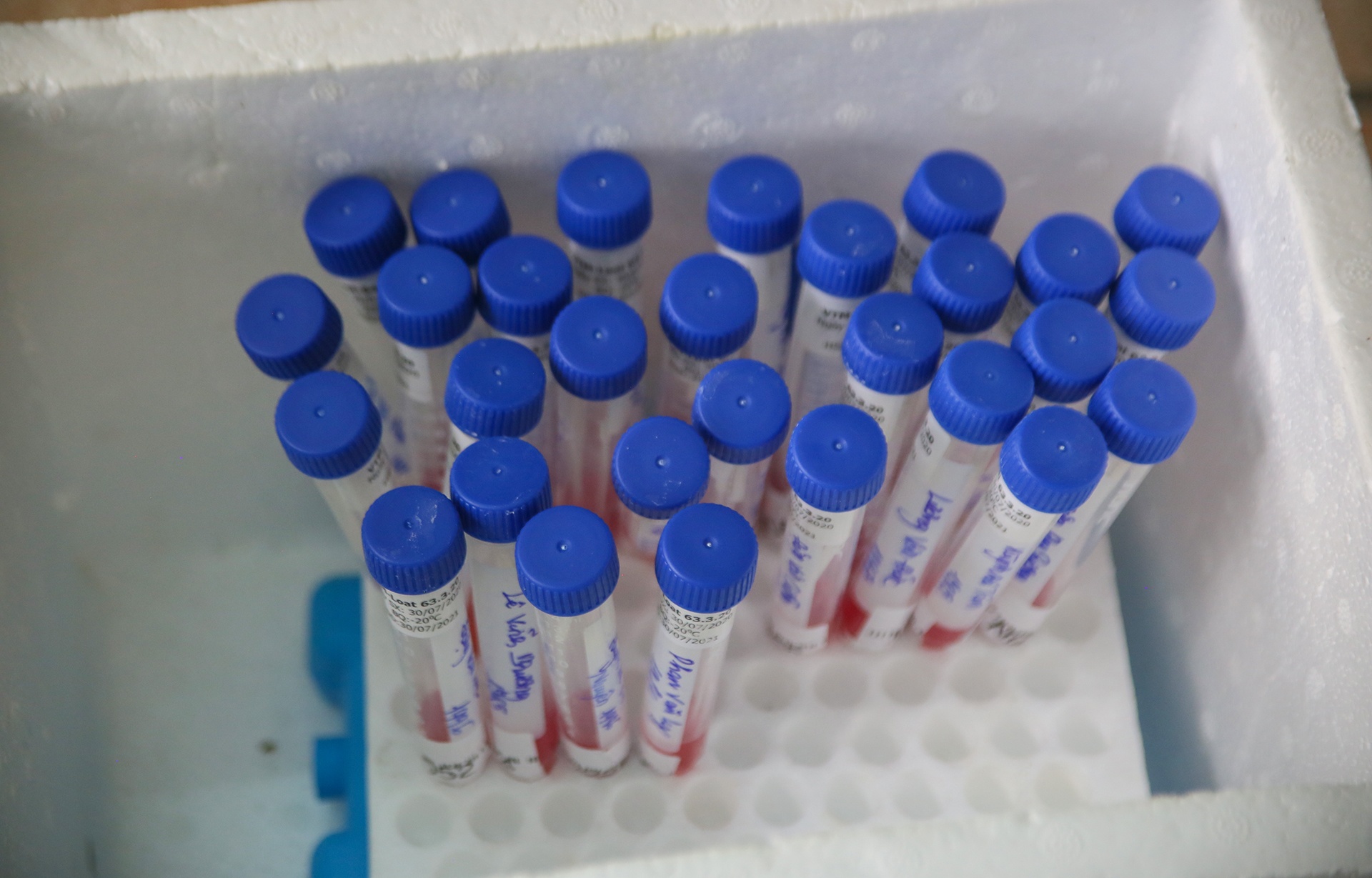 Nguoi dan di xet nghiem dich Covid-19 anh 9