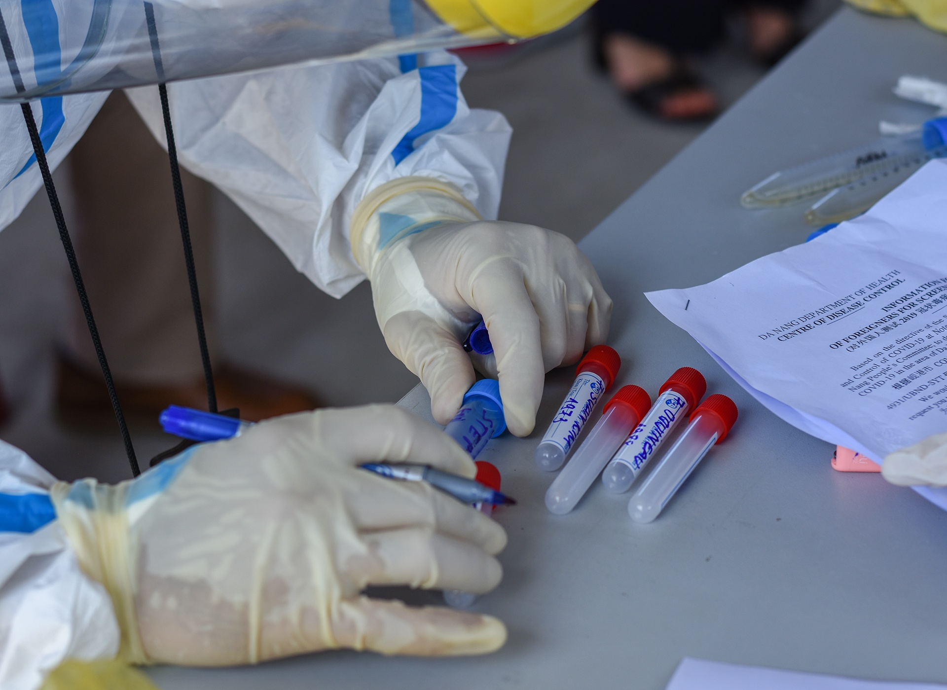 Da Nang co 51 diem nong, nhieu ca duong tinh nCoV chua ro nguon lay hinh anh