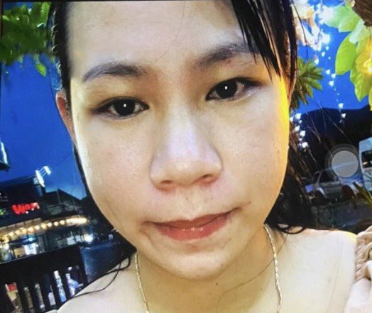 tinh tre trom 3 mieng vang anh 1