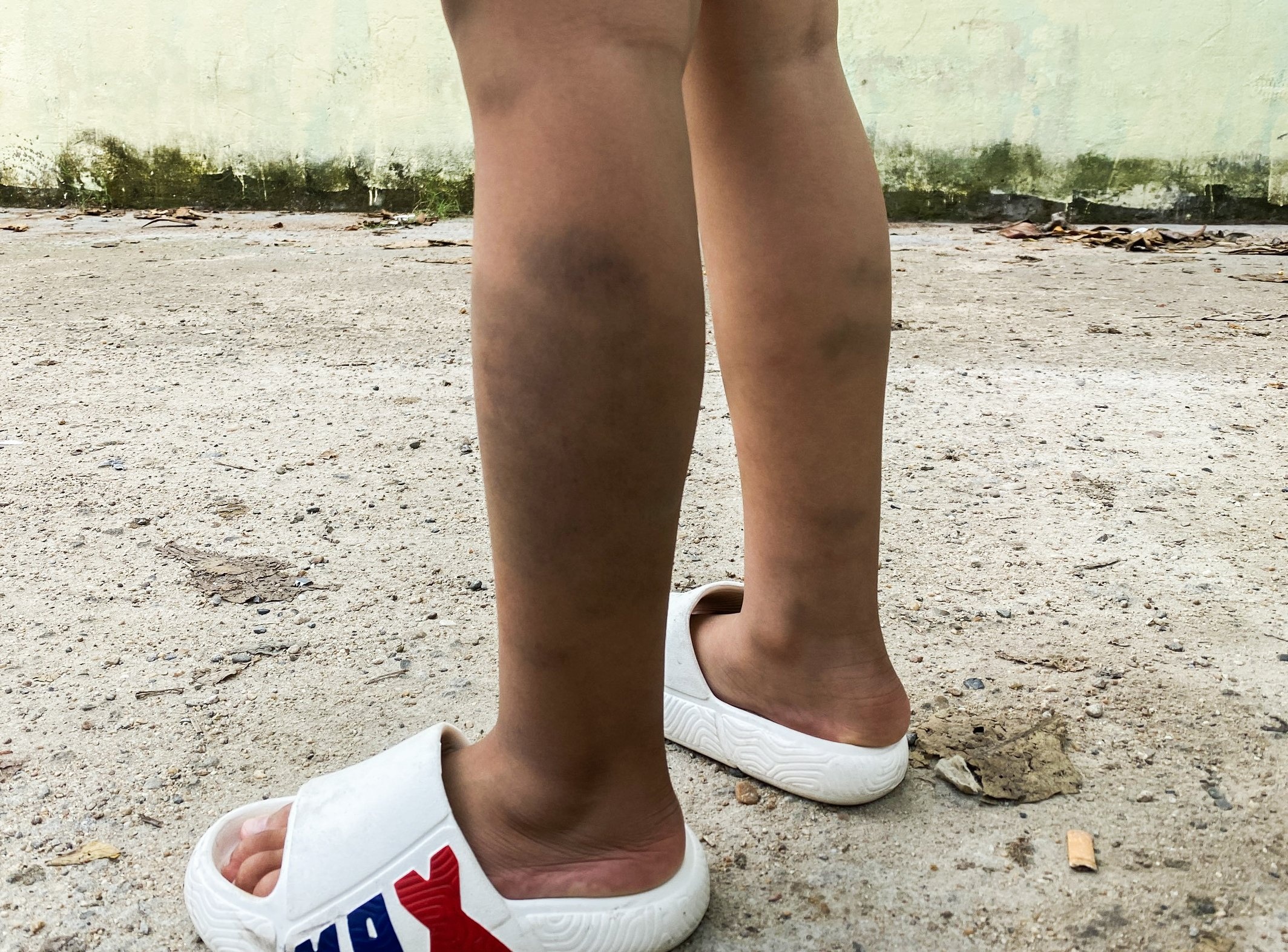 Da Nang tang cuong giam sat truong hoc sau vu tre lop 1 bi danh hinh anh