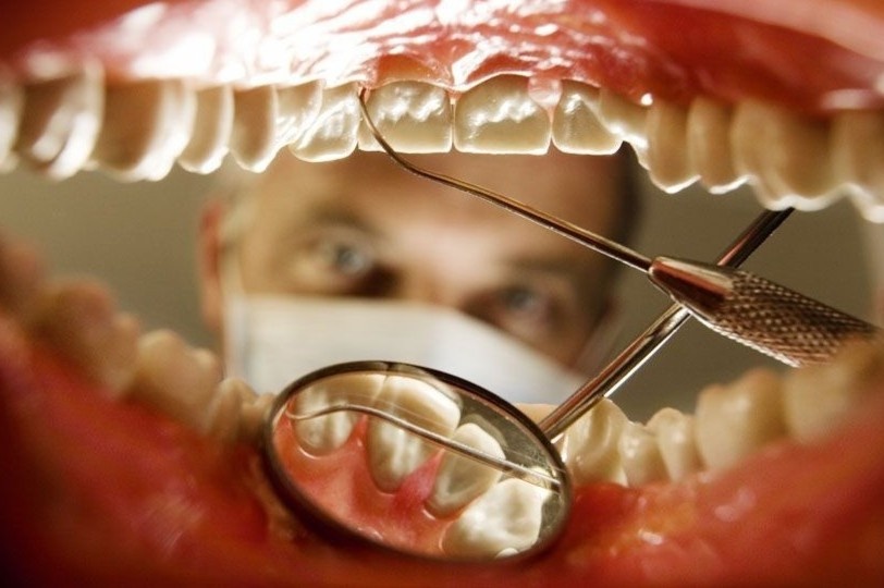 Ket dang vi du lich lam rang gia re o Tho Nhi Ky hinh anh