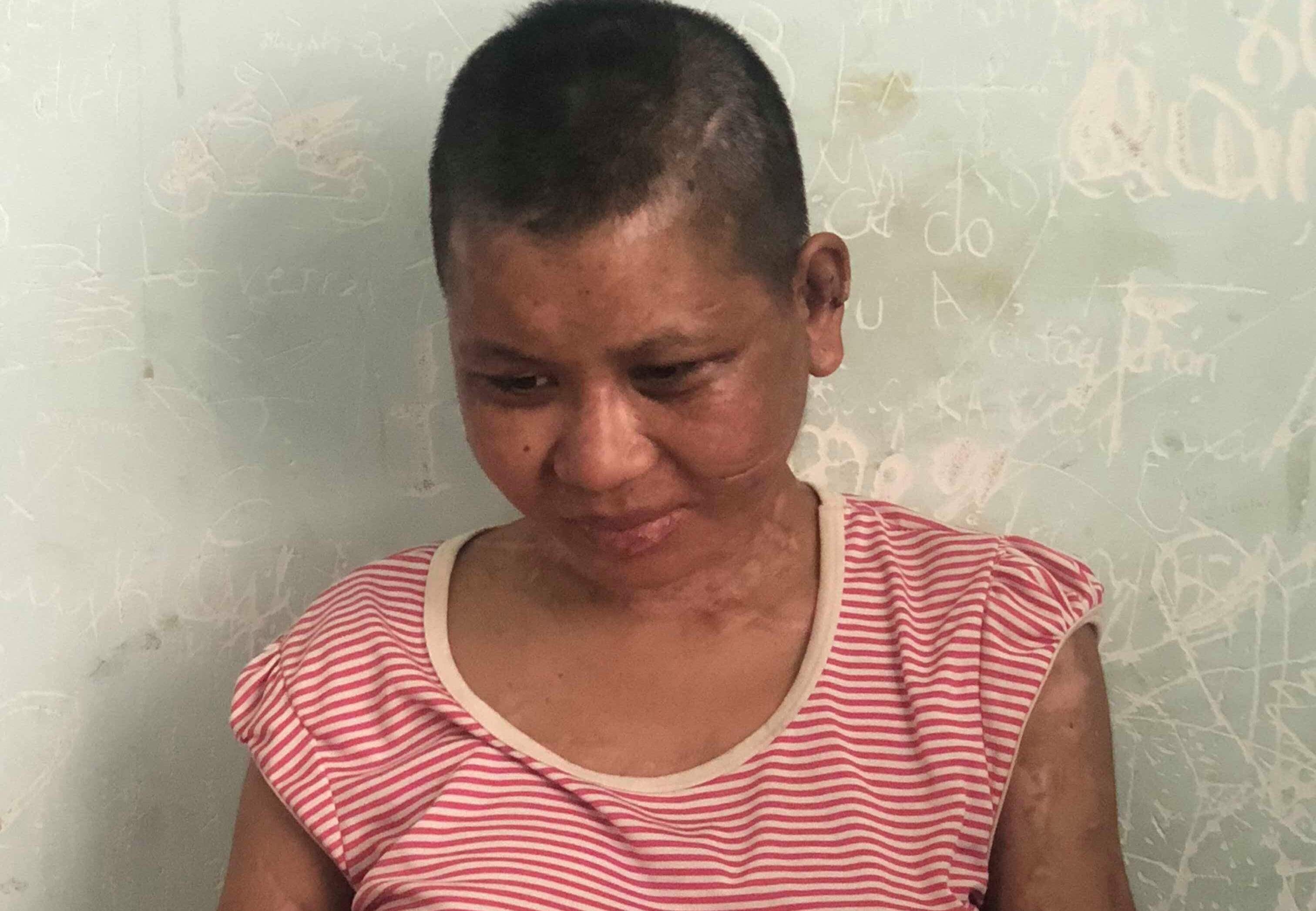 cô gái làm thuê bị tra tấn ảnh 1 co gai lam thue bi tra tan anh 1