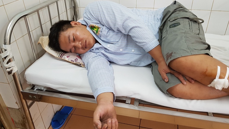 Bat thanh nien chem 3 canh sat hinh su hinh anh