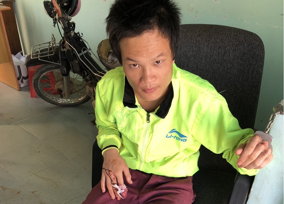Ga trai nghi ngao da hanh hung bo me luc rang sang hinh anh