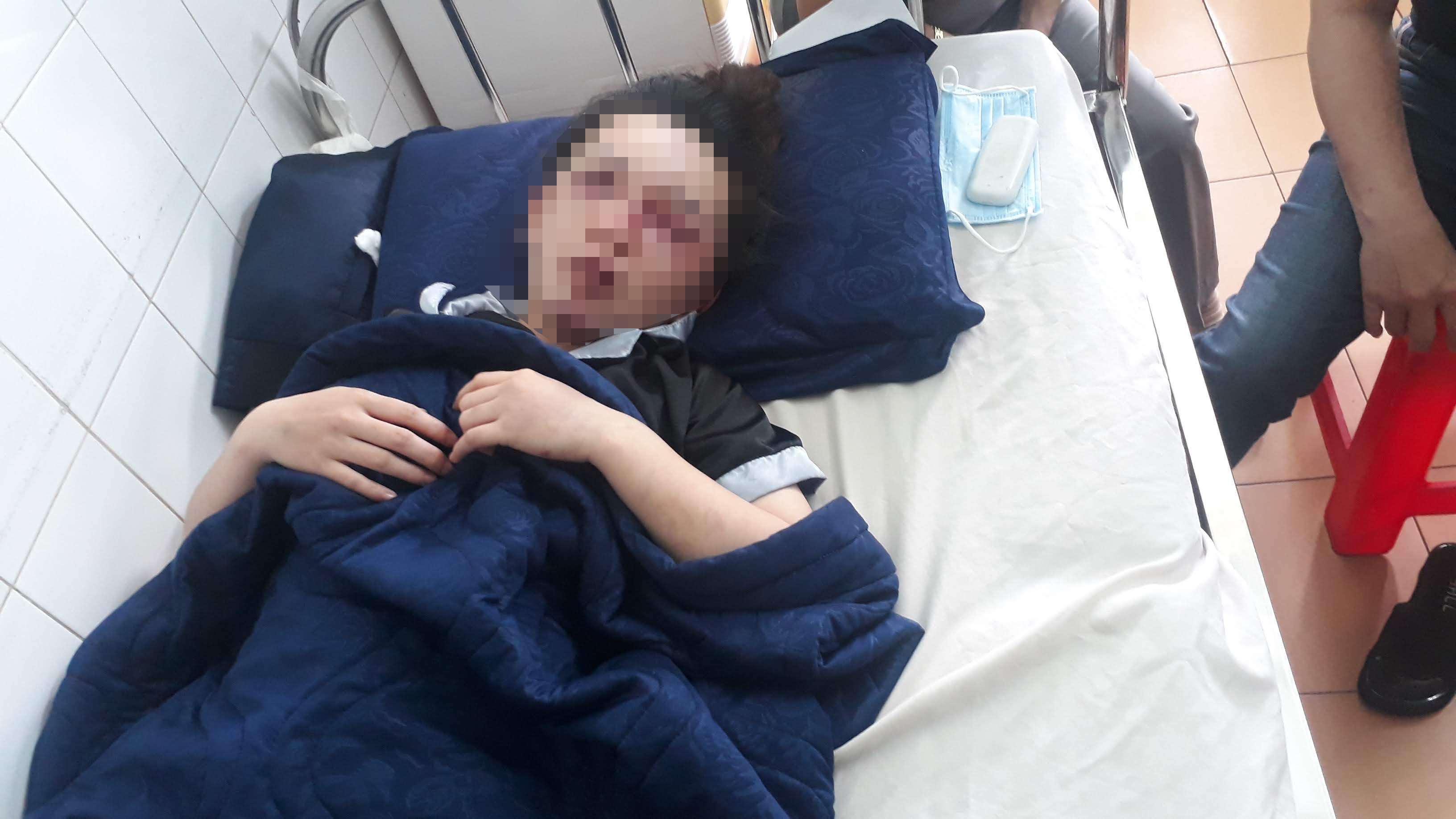 Nu nhan vien spa bi danh bam mat trong dem hinh anh