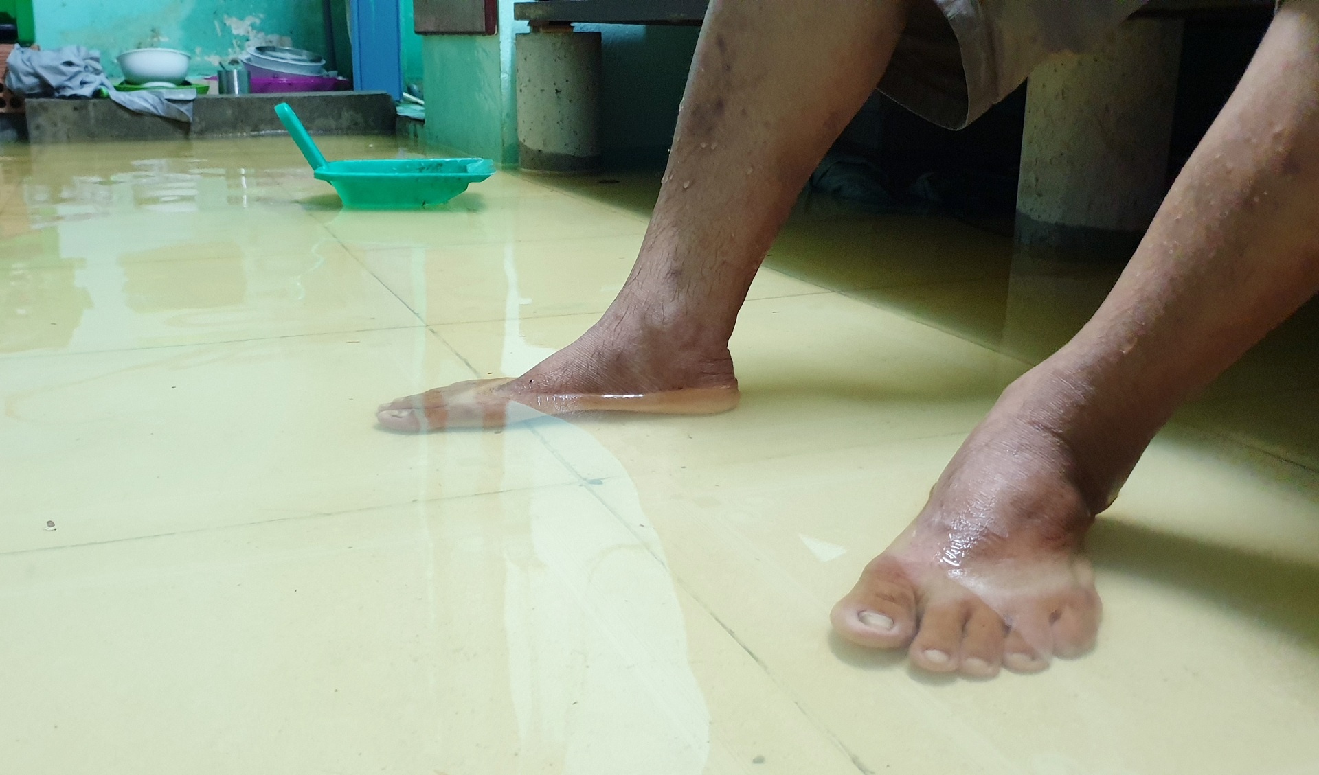 Nguoi dan chong ngap anh 6