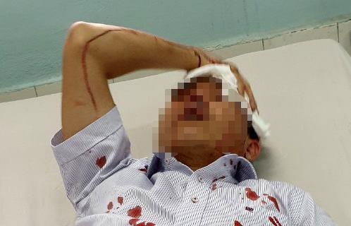 Cồn đồ đánh người ảnh 1 Con do danh nguoi anh 1