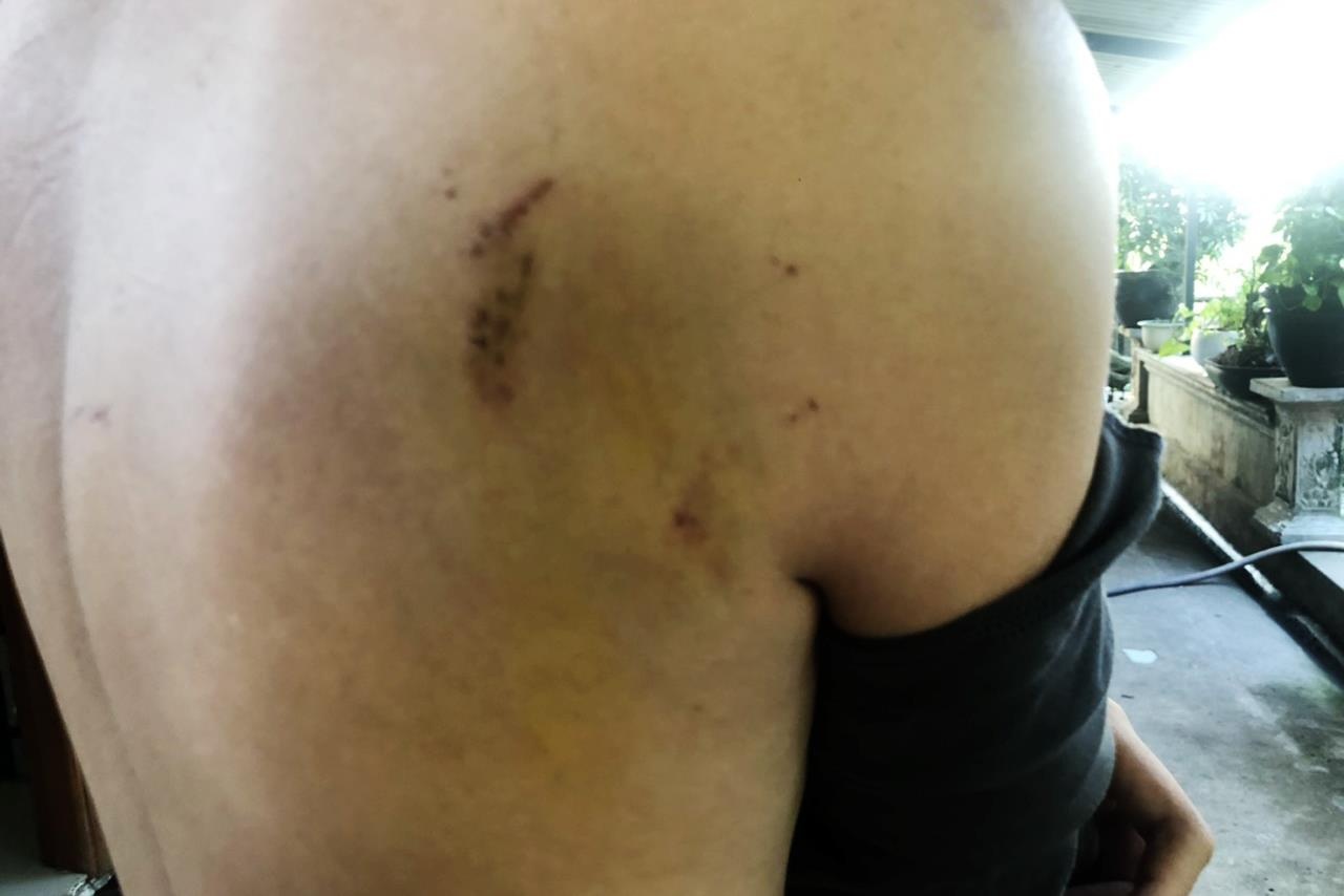 Cướp vào nhà ở Củ Chi ảnh 2 Cuop vao nha o Cu Chi anh 2