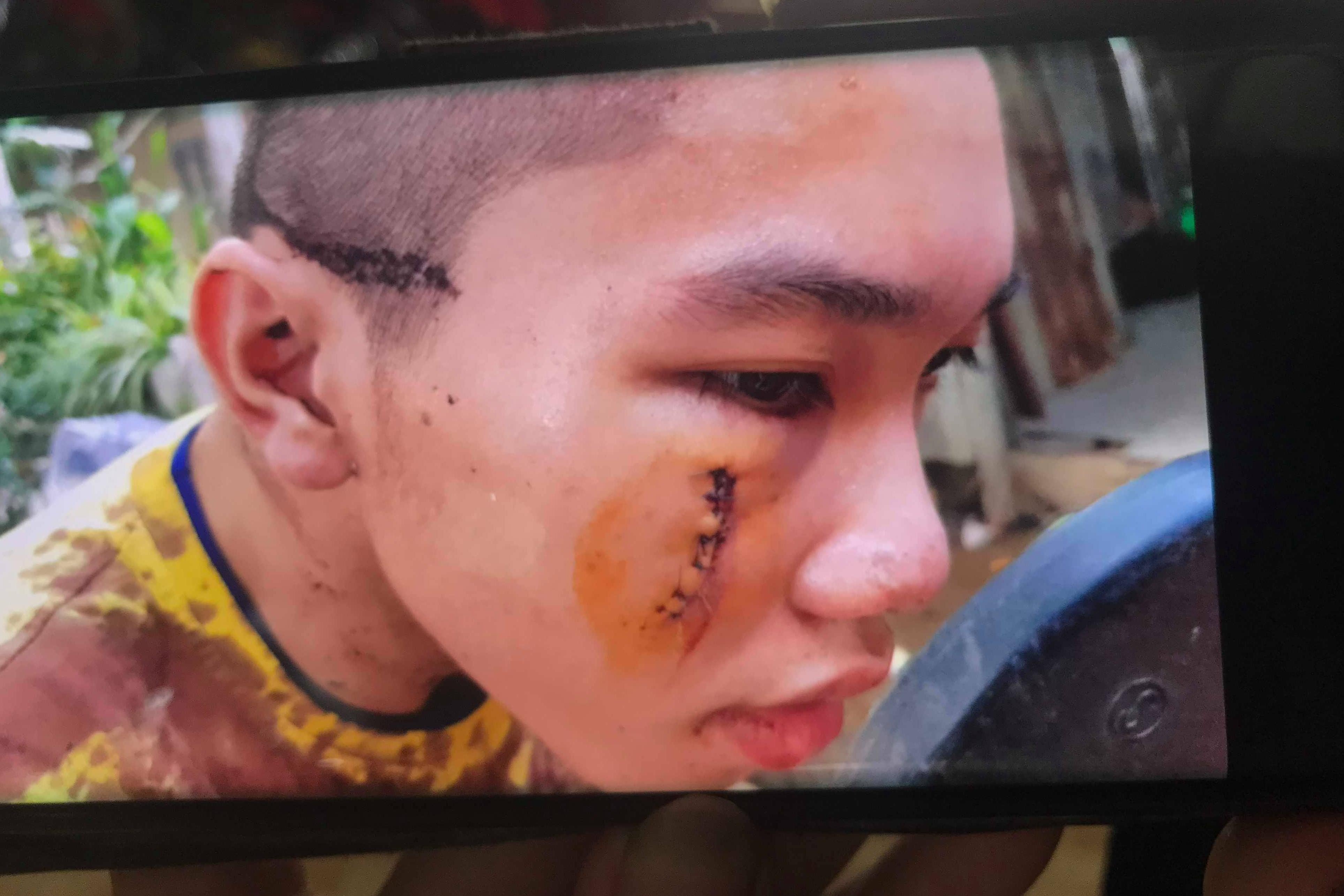 Nguoi cha ly giai viec xong vao Tinh that Bong Lai luc soat hinh anh