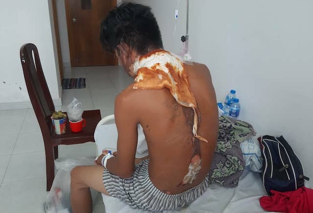 Dội nước sôi lên đầu ảnh 1 Doi nuoc soi len dau anh 1