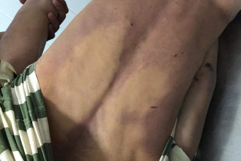 Pham nhan tu vong trong nha giam anh 1