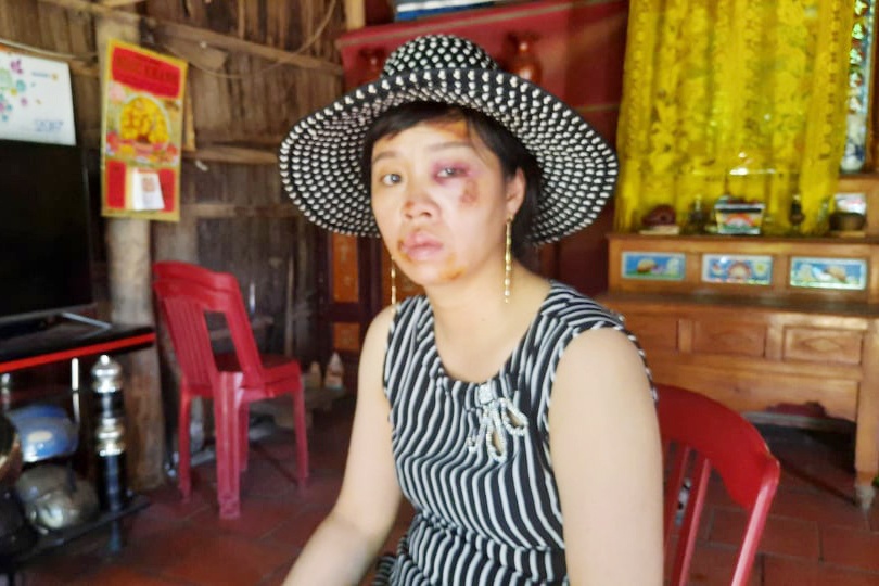 cuop giat tui xach anh 1