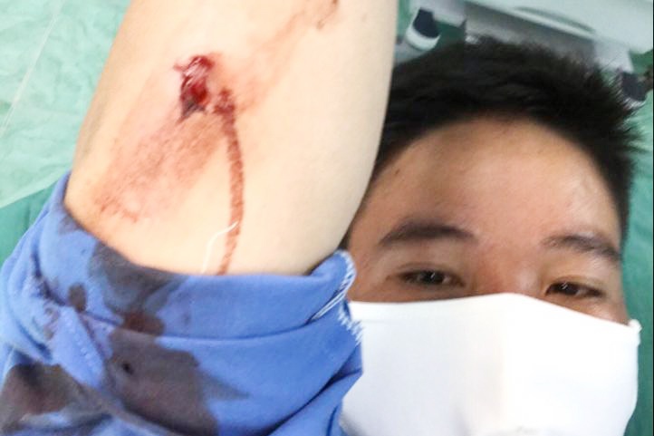 chong nguoi thi hanh cong vu anh 1