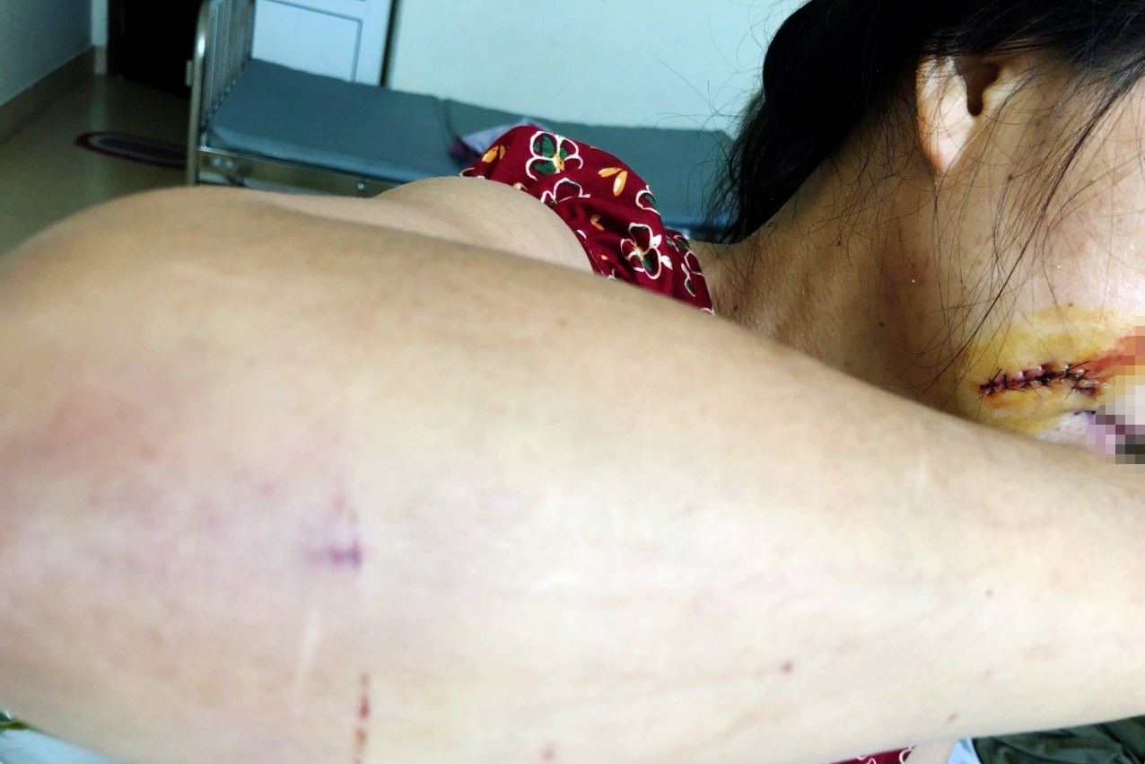 chém người tình ảnh 1 chem nguoi tinh anh 1