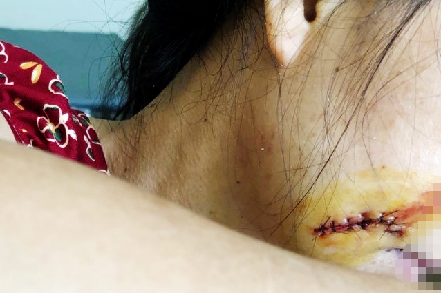 Ga dan ong chem nguoi tinh trong con say hinh anh