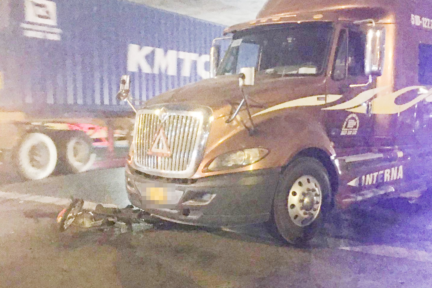 Be gai o TP.HCM bi xe dau keo can tu vong hinh anh