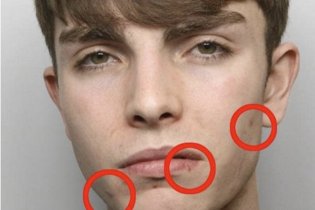 Vet cao tren mat lat tay toi giet ban gai cua nam sinh 17 tuoi hinh anh