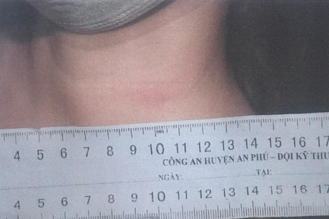 trinh bao gia bi cuop anh 2