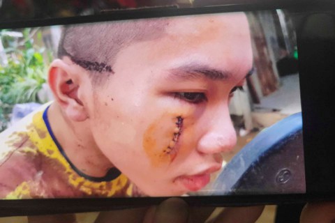 Tinh that Bong Lai anh 3