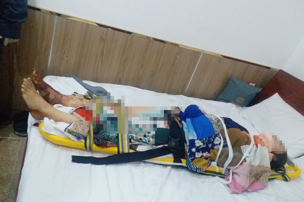 roi thang may khach san anh 1