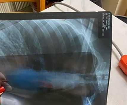 Nu hanh khach bi tai xe xe cong nghe hanh hung o TP.HCM hinh anh